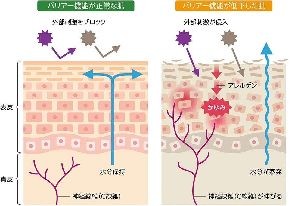 皮膚の断面図が2つ並んだイラスト。左側は「バリア機能が正常な肌」を示し、角質層が整った状態で外部刺激がブロックされ、水分が皮膚内部に保持されている様子が描かれている。右側は「バリア機能が低下した肌」を示し、角質層が乱れている状態で外部刺激が侵入し、アレルゲンと接触することで「かゆみ」が発生。さらに水分が蒸発している様子が描かれている。真皮部分では神経線維(C線維)が肌の表面付近まで伸びており、炎症やかゆみを悪化させる状態を示している。